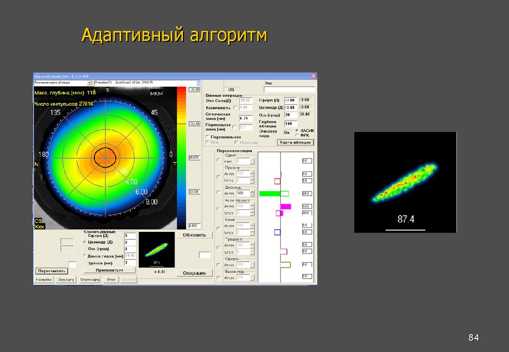 Адаптивный алгоритм
