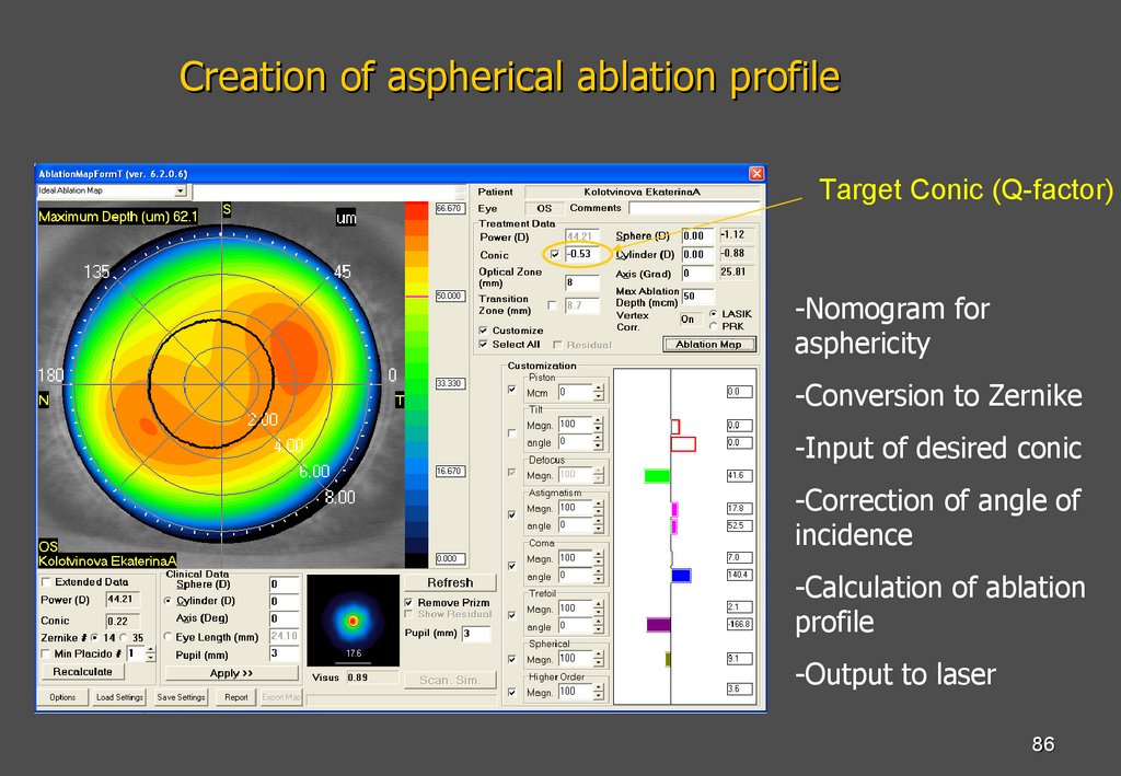 Creation of aspherical ablation profile