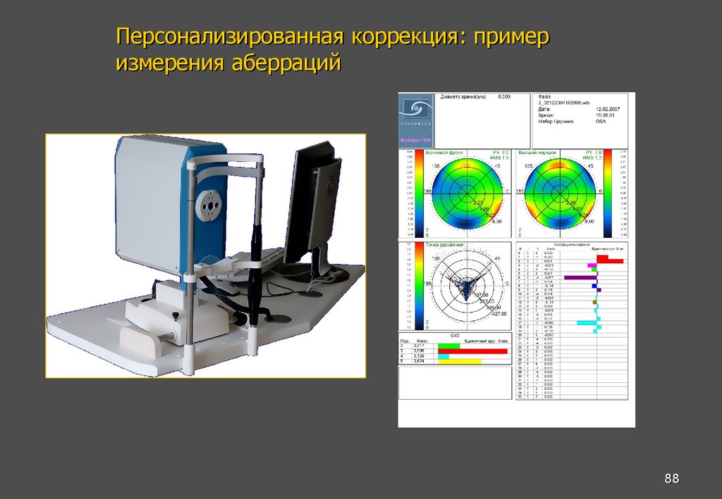 Персонализированная коррекция: пример измерения аберраций