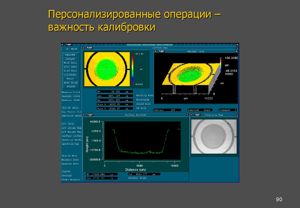 Персонализированные операции – важность калибровки