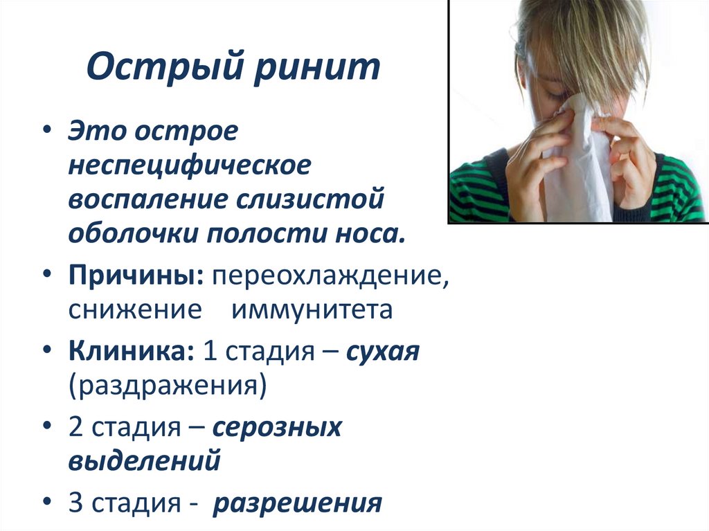 Острый ринит