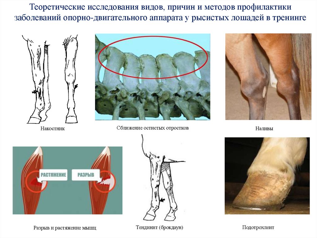 Сближение остистых отростков