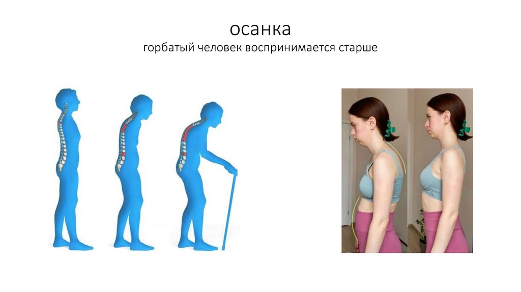 осанка горбатый человек воспринимается старше