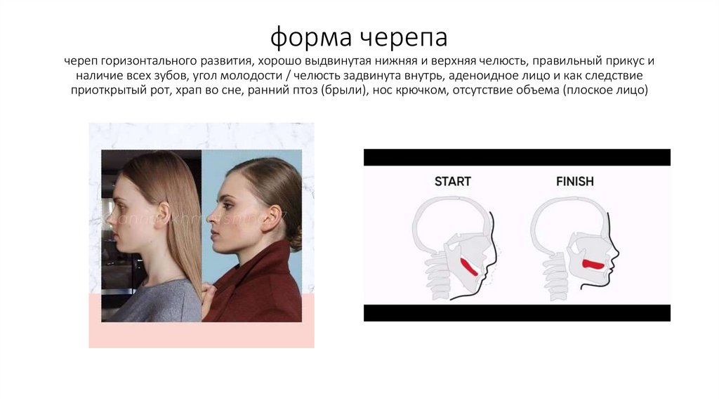 форма черепа череп горизонтального развития, хорошо выдвинутая нижняя и верхняя челюсть, правильный прикус и наличие всех