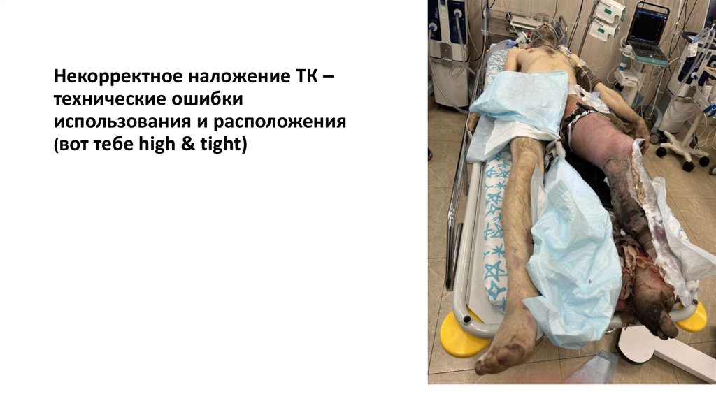 Некорректное наложение ТК – технические ошибки использования и расположения (вот тебе high & tight)