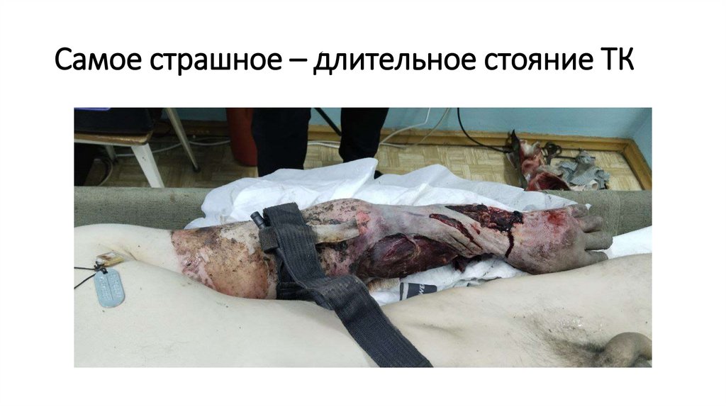 Самое страшное – длительное стояние ТК