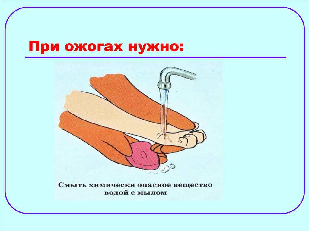 При ожогах нужно: