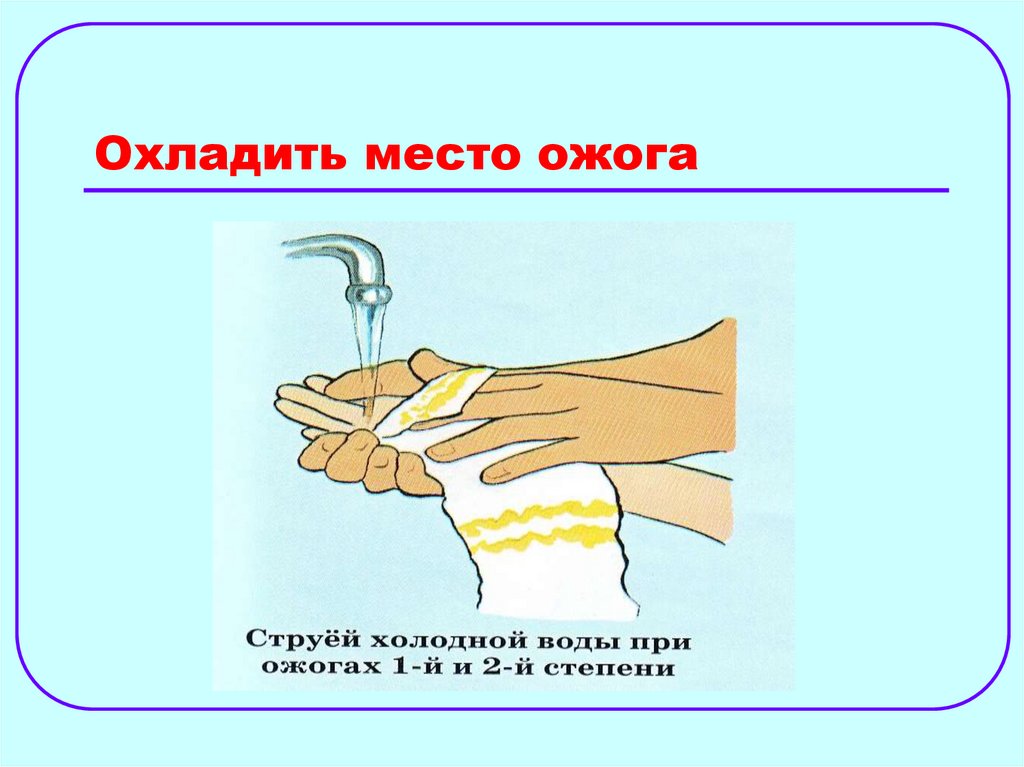 Охладить место ожога