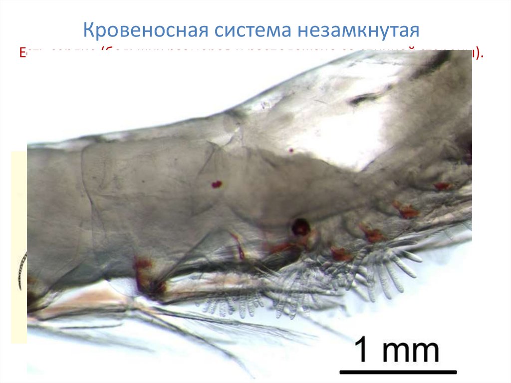 Кровеносная система незамкнутая Есть сердце (больших размеров и расположено со спинной стороны). Кровь у большинства