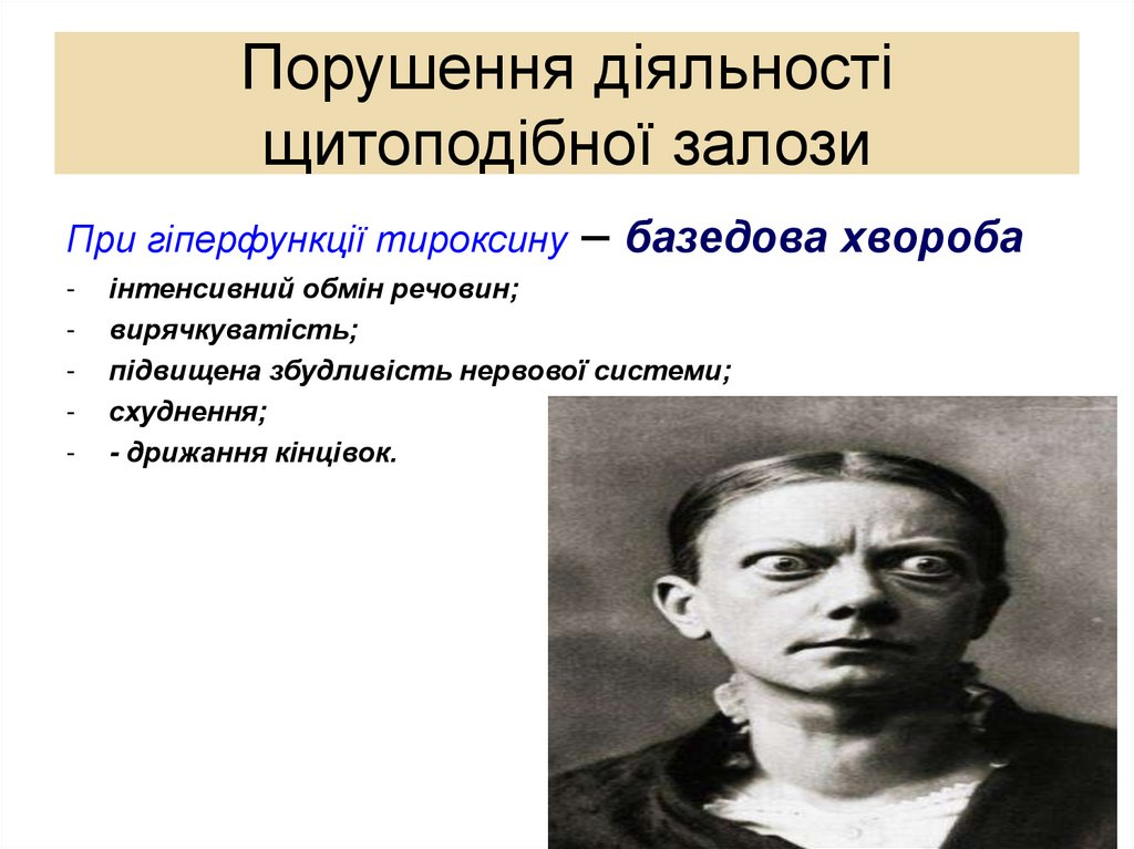 Порушення діяльності щитоподібної залози
