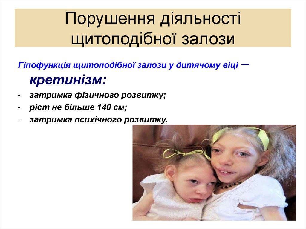 Порушення діяльності щитоподібної залози