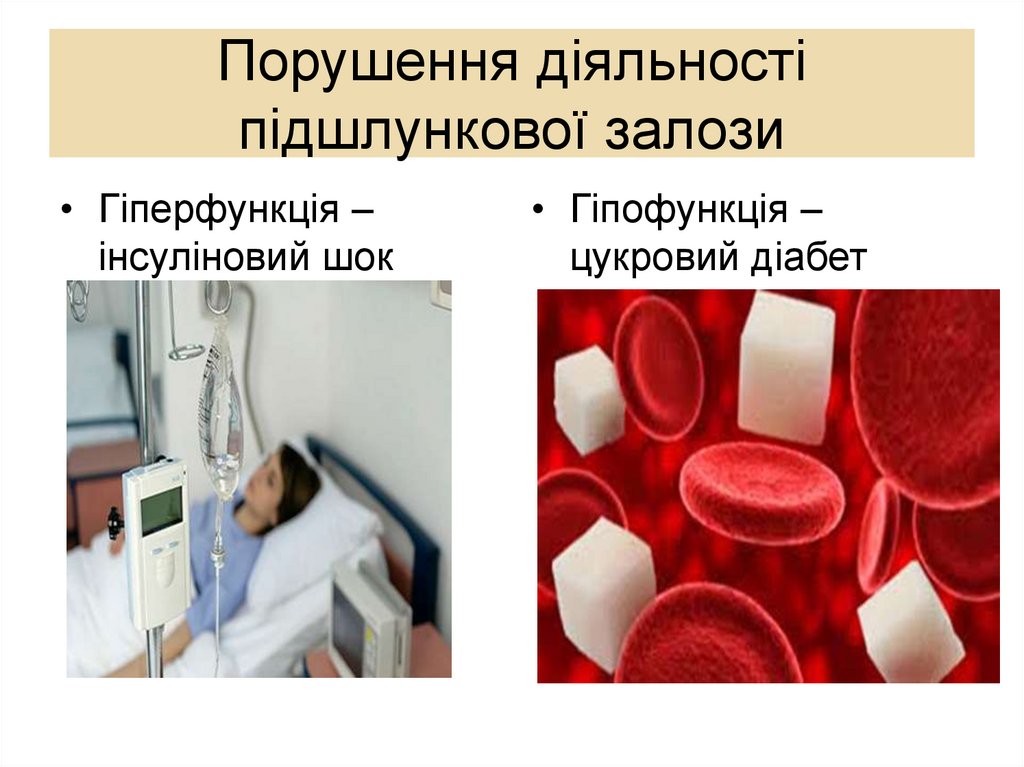 Порушення діяльності підшлункової залози