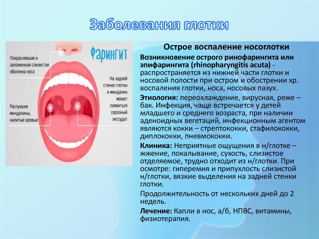 Заболевания глотки