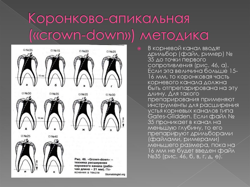 Коронково-апикальная («crown-down») методика