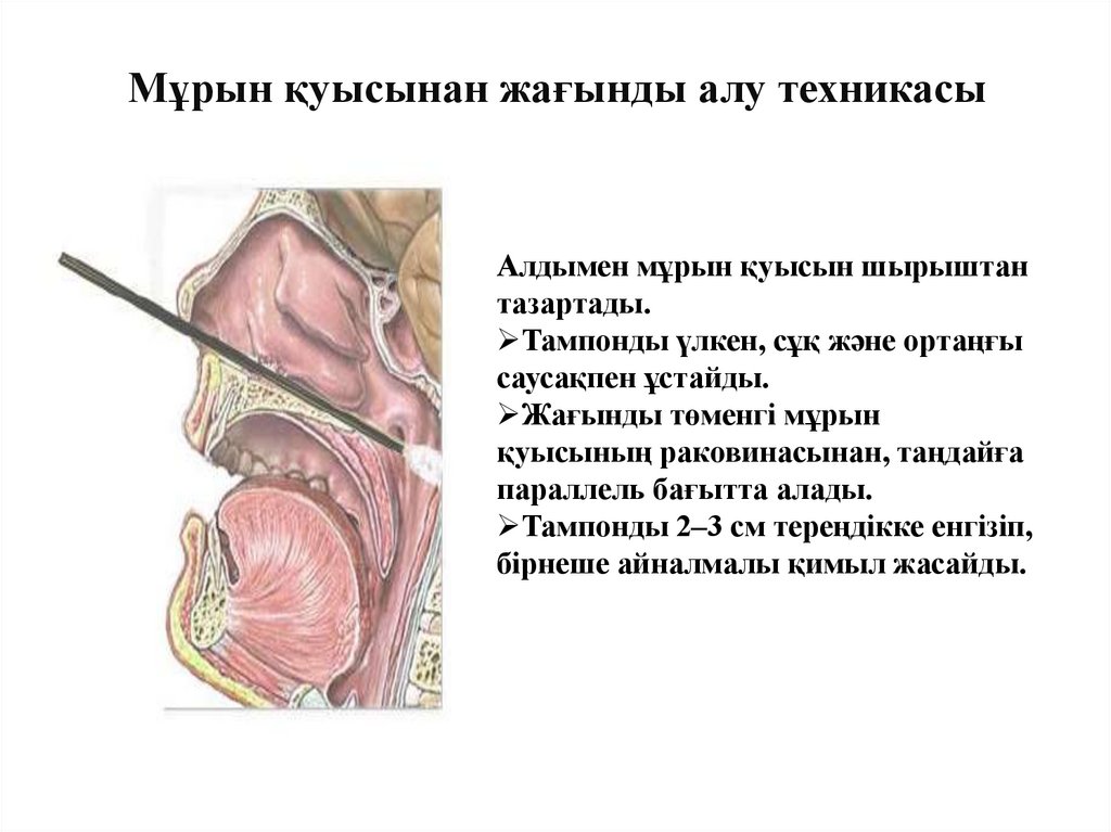 Мұрын қуысынан жағынды алу техникасы
