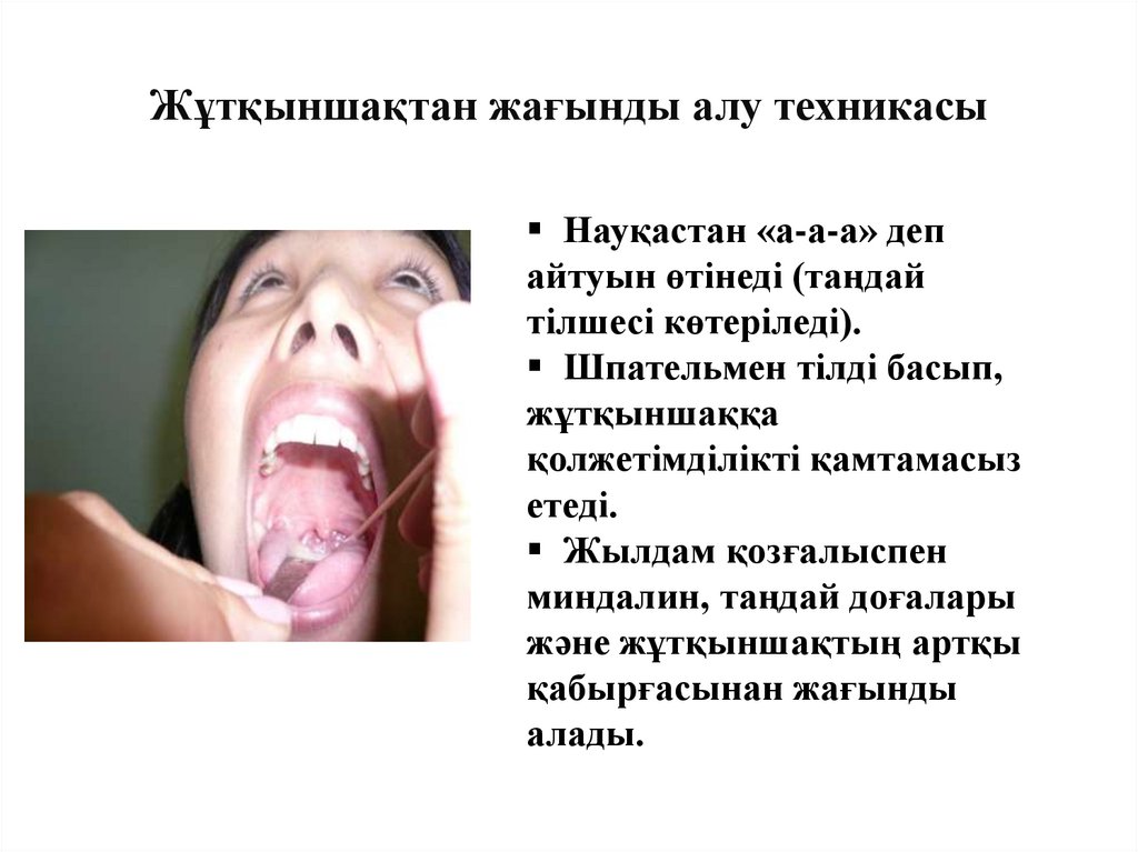 Жұтқыншақтан жағынды алу техникасы