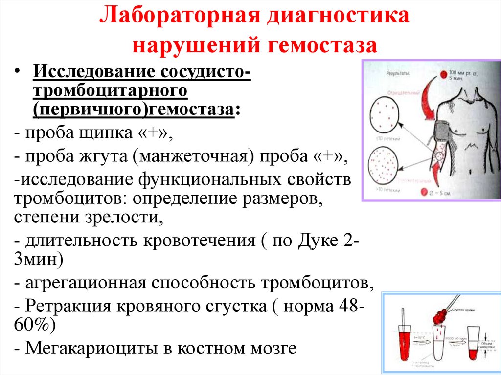 Лабораторная диагностика нарушений гемостаза