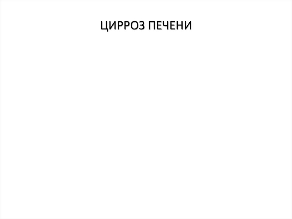 ЦИРРОЗ ПЕЧЕНИ