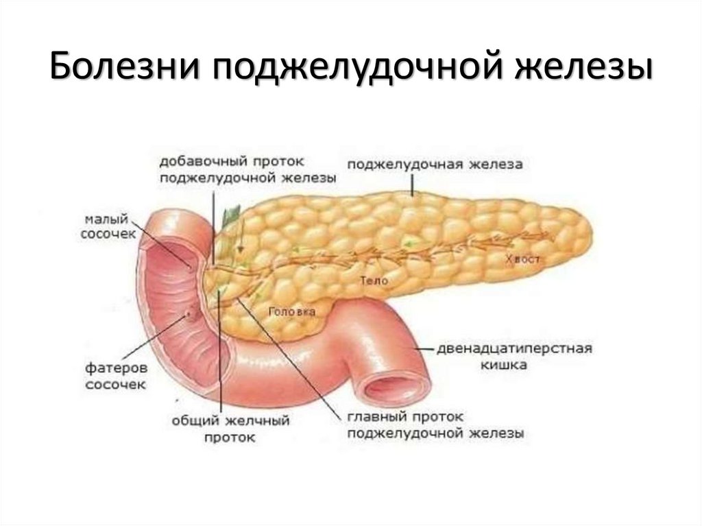 Болезни поджелудочной железы