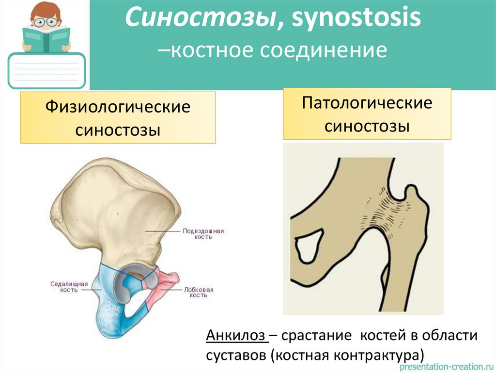 Синостозы, synostosis –костное соединение