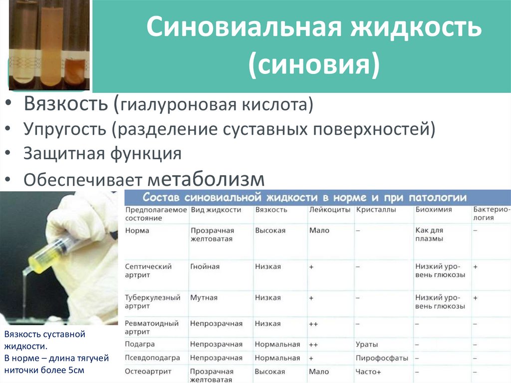 Синовиальная жидкость (синовия)