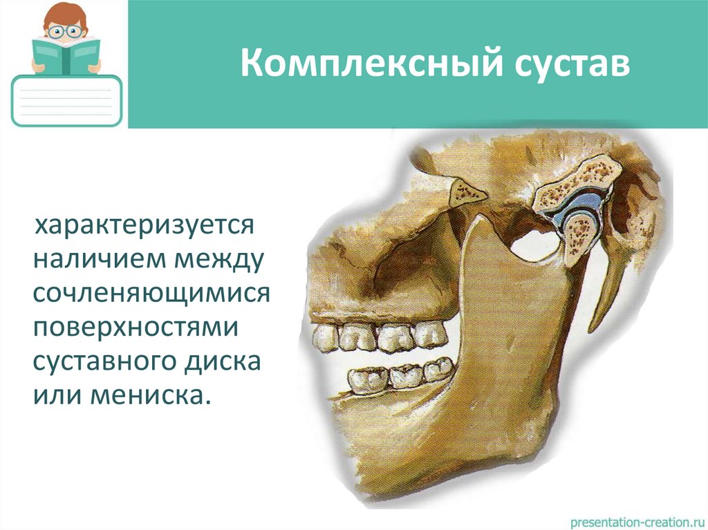 Комплексный сустав