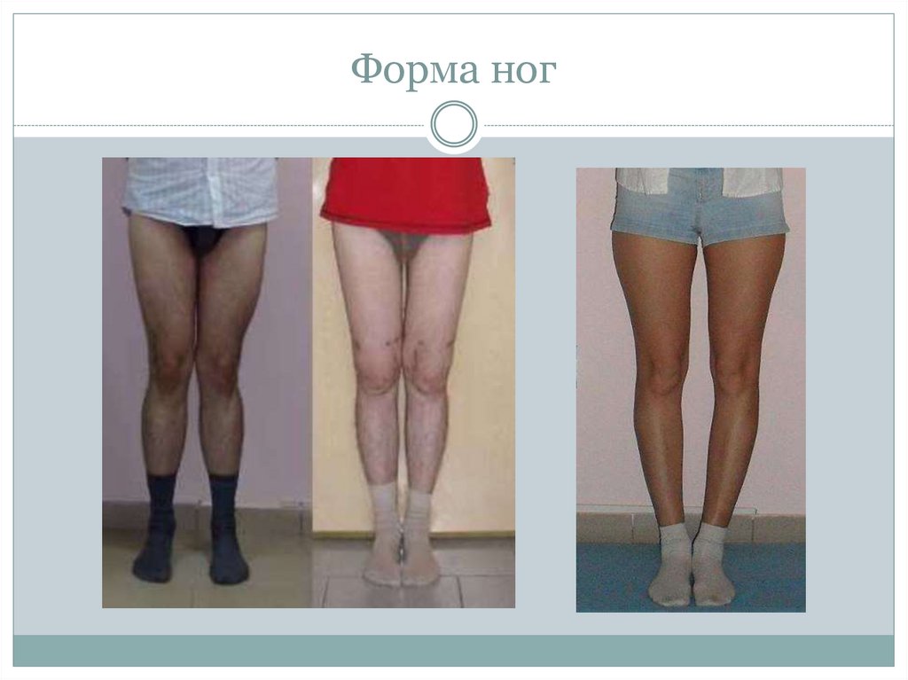 Форма ног