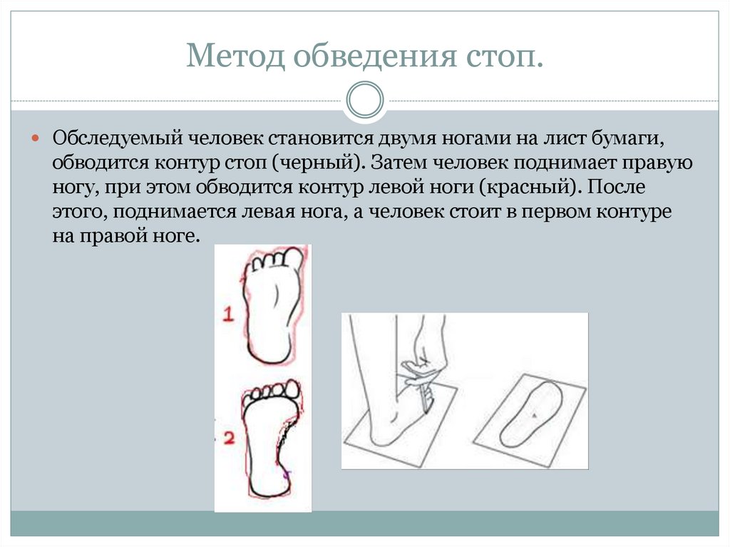 Метод обведения стоп.