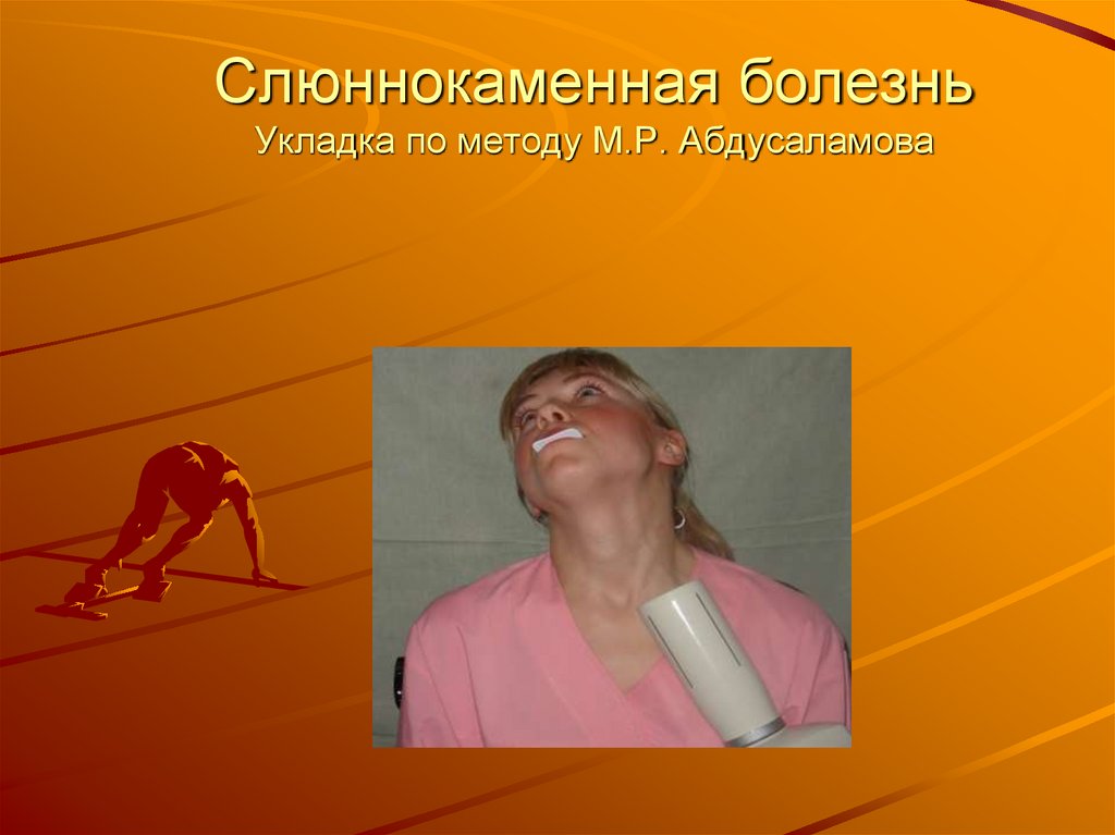 Слюннокаменная болезнь Укладка по методу М.Р. Абдусаламова