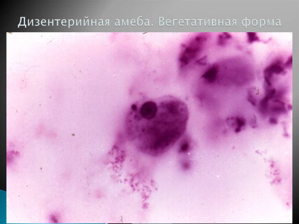 Дизентерийная амеба. Вегетативная форма