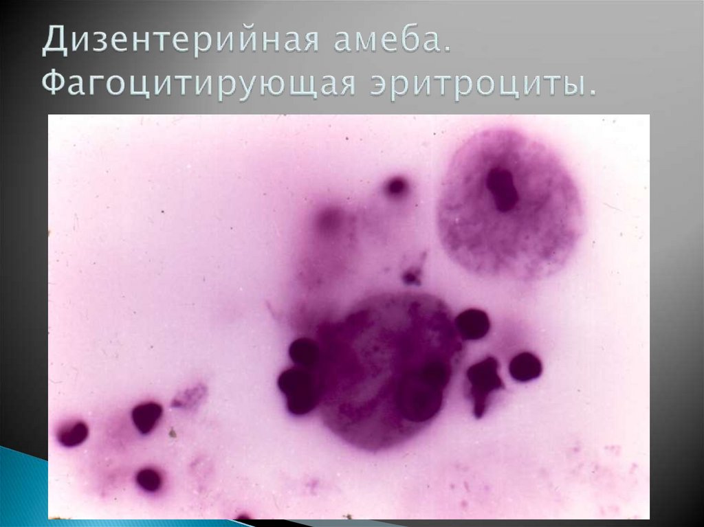 Дизентерийная амеба. Фагоцитирующая эритроциты.