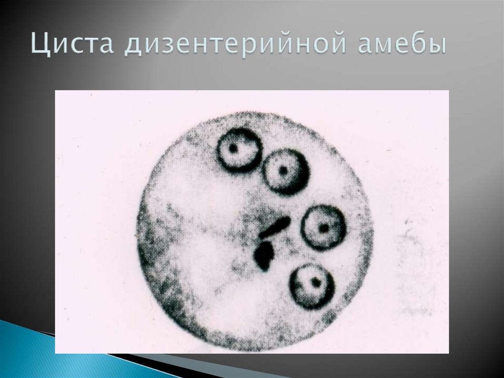 Циста дизентерийной амебы