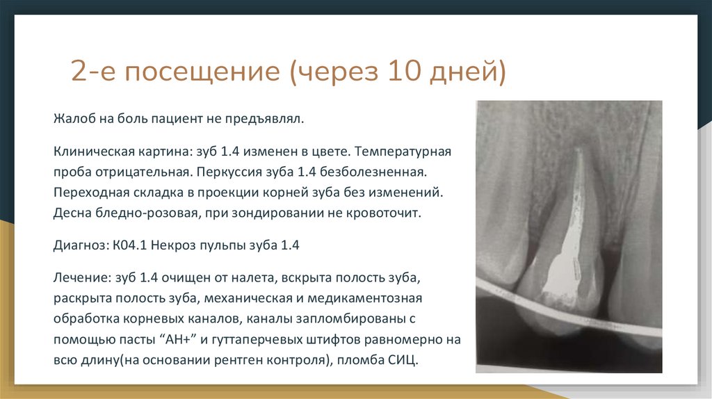 2-е посещение (через 10 дней)