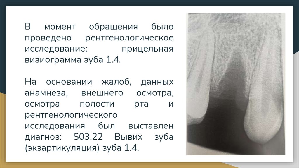 В момент обращения было проведено рентгенологическое исследование: прицельная визиограмма зуба 1.4. На основании жалоб, данных