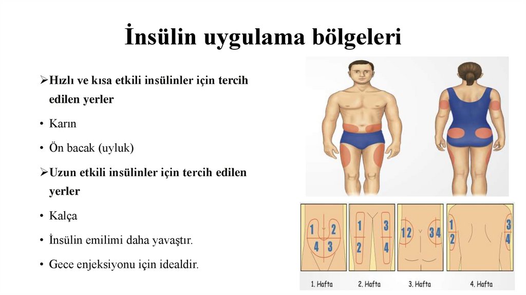 İnsülin uygulama bölgeleri
