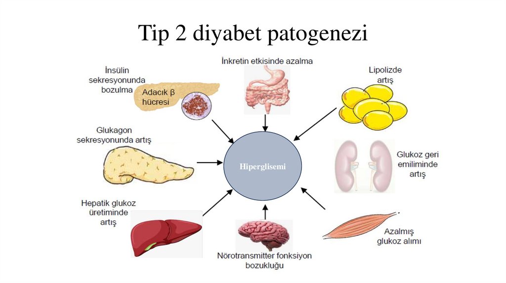 Tip 2 diyabet patogenezi