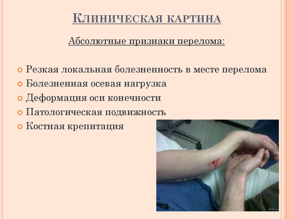 Клиническая картина