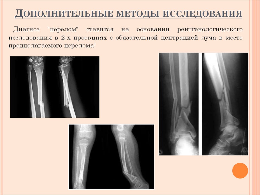 Дополнительные методы исследования
