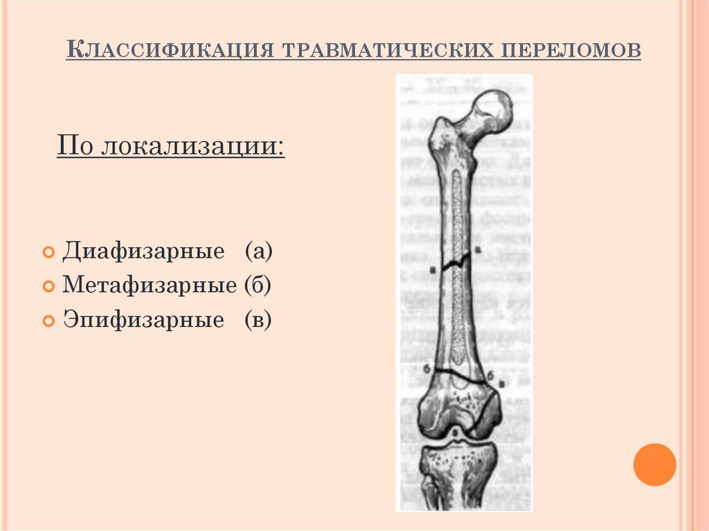 Классификация травматических переломов