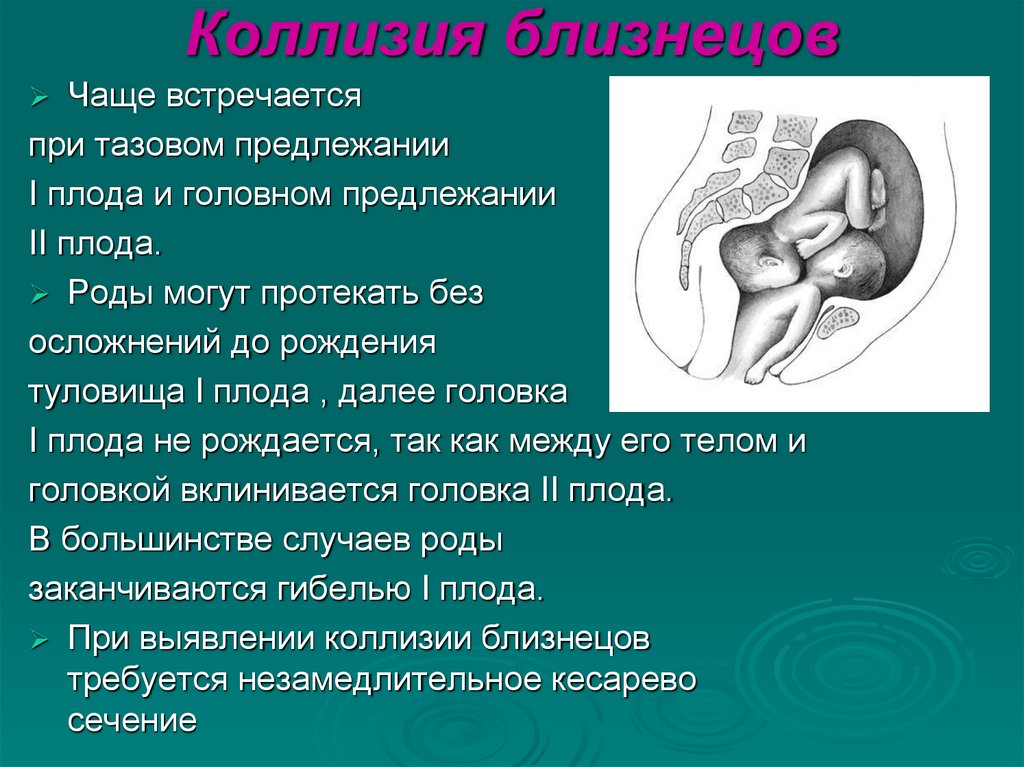 Коллизия близнецов