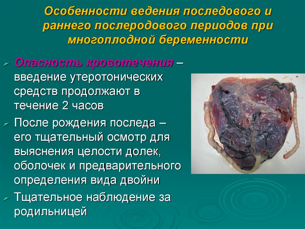 Особенности ведения последового и раннего послеродового периодов при многоплодной беременности