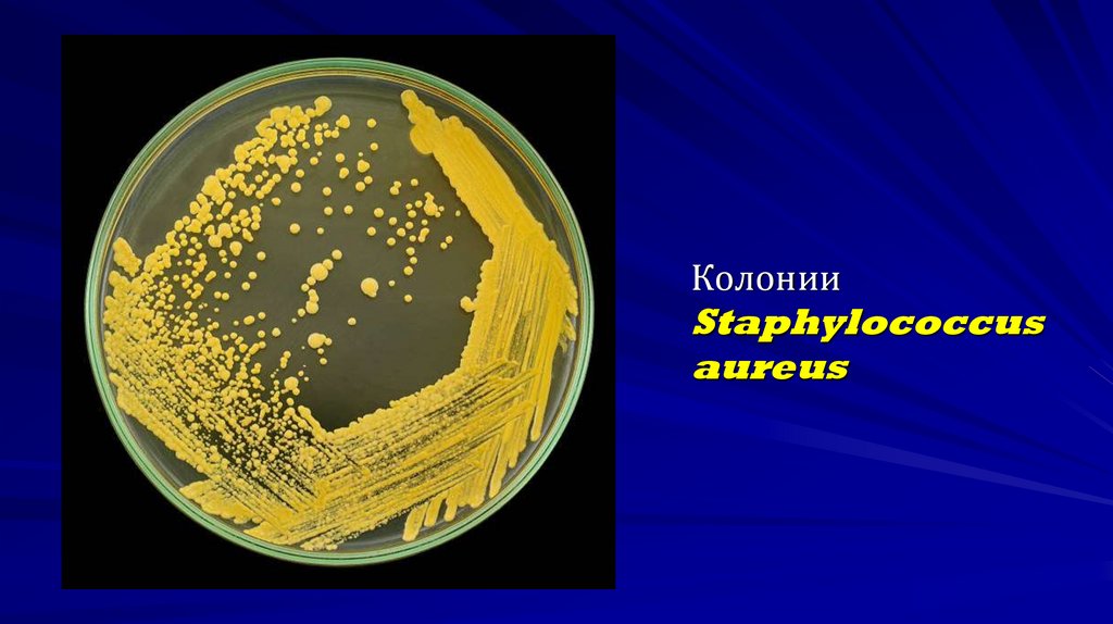 Колонии Staphylococcus aureus