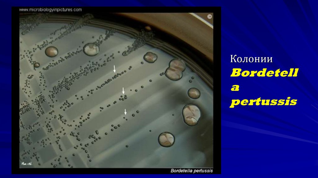 Колонии Bordetella pertussis
