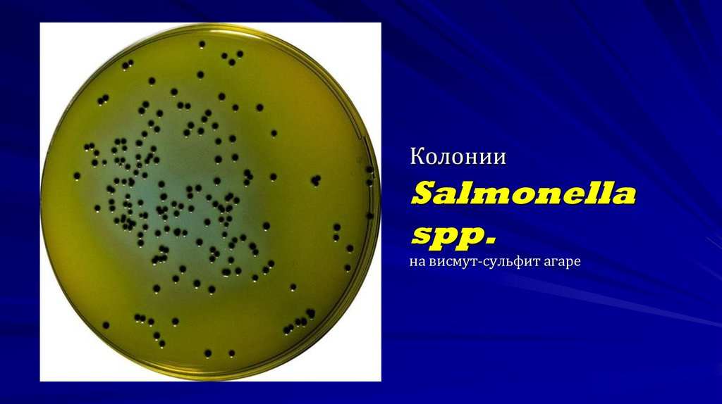 Колонии Salmonella spp. на висмут-сульфит агаре
