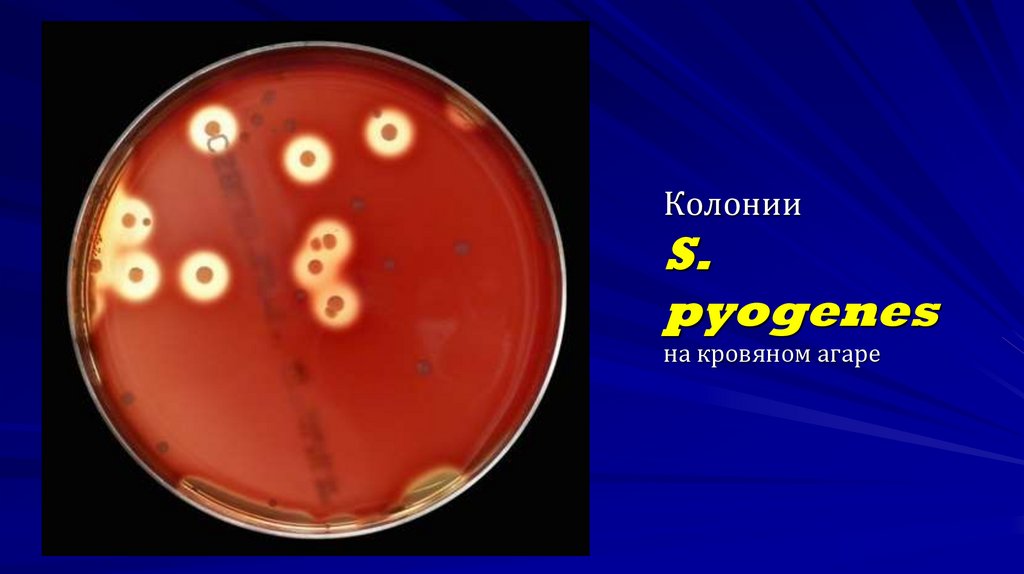 Колонии S. pyogenes на кровяном агаре