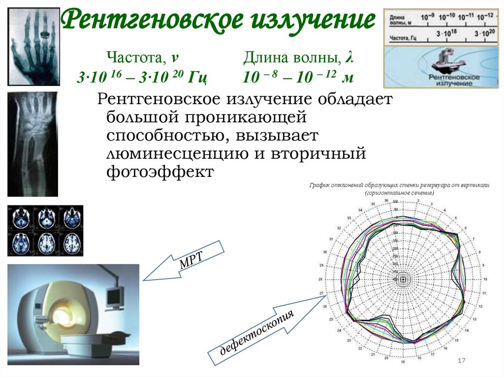 Рентгеновское излучение