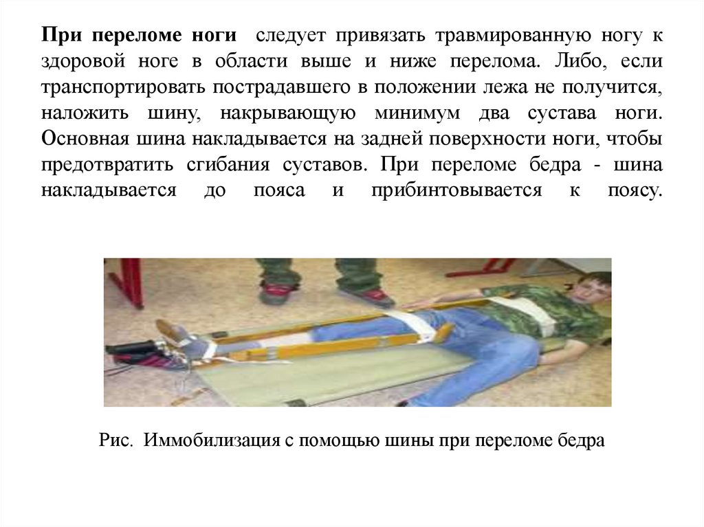 При переломе ноги  следует привязать травмированную ногу к здоровой ноге в области выше и ниже перелома. Либо, если