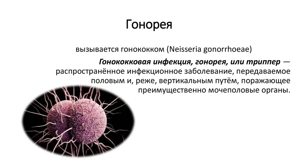 Гонорея