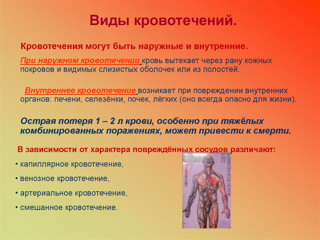 Виды кровотечений.