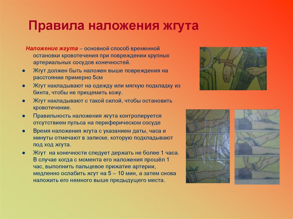 Правила наложения жгута